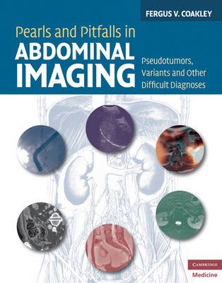 Pearls and Pitfalls in Abdominal Imaging. Pseudotumors, Variants and Other Difficult Diagnoses