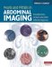 Pearls and Pitfalls in Abdominal Imaging. Pseudotumors, Variants and Other Difficult Diagnoses