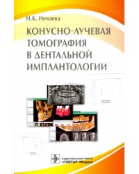Конусно-лучевая томография в дентальной имплантологии