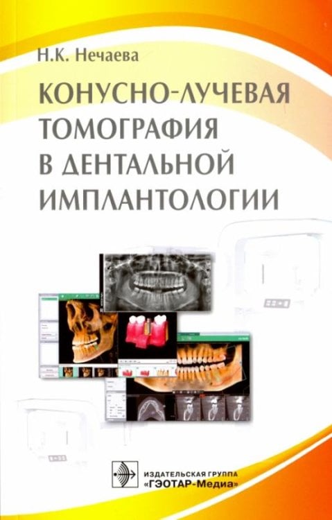 Обложка книги «Конусно-лучевая томография в дентальной имплантологии» — Нечаева Наталья Константиновна, ISBN 9785970437964