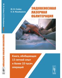 Эндовенозная лазерная облитерация