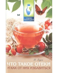 Что такое отеки и как от них избавиться