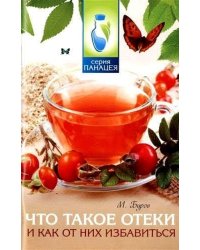 Что такое отеки и как от них избавиться