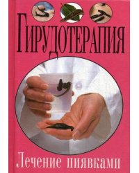 Гирудотерапия. Лечение пиявками