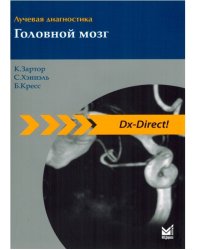 Лучевая диагностика. Головной мозг