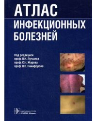 Атлас инфекционных болезней. Гриф УМО по медицинскому образованию