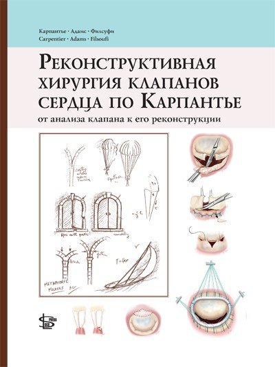 Обложка книги «Реконструктивная хирургия клапанов сердца по Карпантье: от анализа клапана до его реконструкции» — Карпантье А., Адамс Д.Г., Филсуфи Ф., ISBN 9785986570662