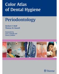 Color Atlas of Dental Hygiene: Periodontology
