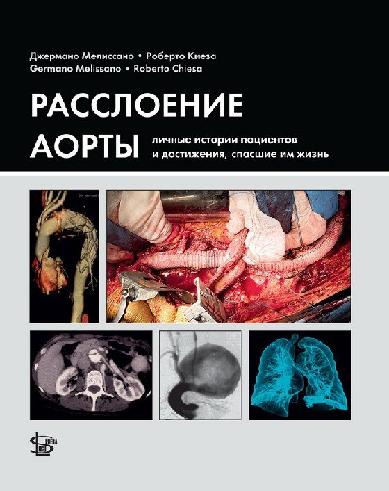 Обложка книги «Расслоение аорты: личные истории пациентов и достижения, спасшие им жизнь» — Мелиссано Дж. , Киеза Р., ISBN 9785986570693