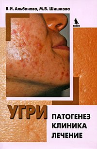 Обложка книги «Угри. Патогенез. Клиника. Лечение» — Альбанова В.И., Шишкова М.В., ISBN 9785951803498