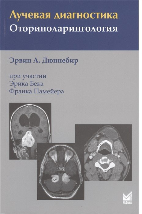 Лучевая диагностика. Оториноларингология
