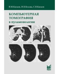Компьютерная томография в пульмонологии