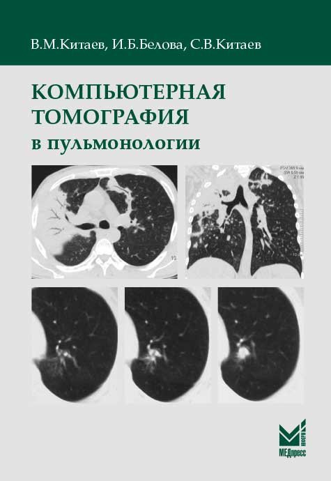 Обложка книги «Компьютерная томография в пульмонологии» — Китаев В.М., Белова И.Б., Китаев С.В., ISBN 9785000309285