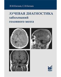 Лучевая диагностика заболеваний головного мозга