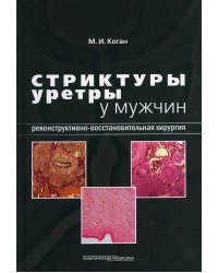 Стриктуры уретры у мужчин. Реконструктивно-восстановительная хирургия