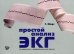Простой анализ ЭКГ: интерпретация, дифференциальный диагноз
