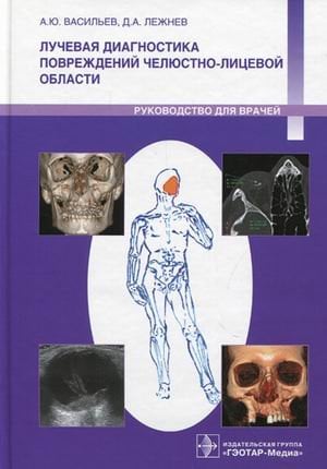 Лучевая диагностика повреждений челюстно-лицевой области. Руководство для врачей