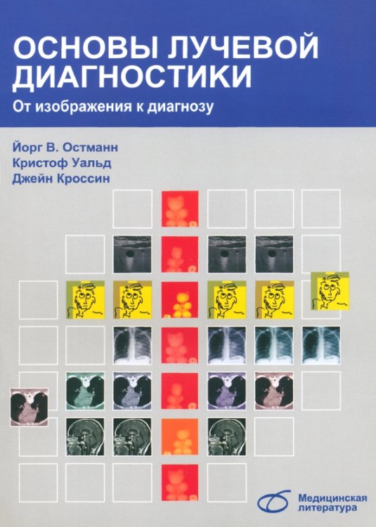 Основы лучевой диагностики. От изображения к диагнозу