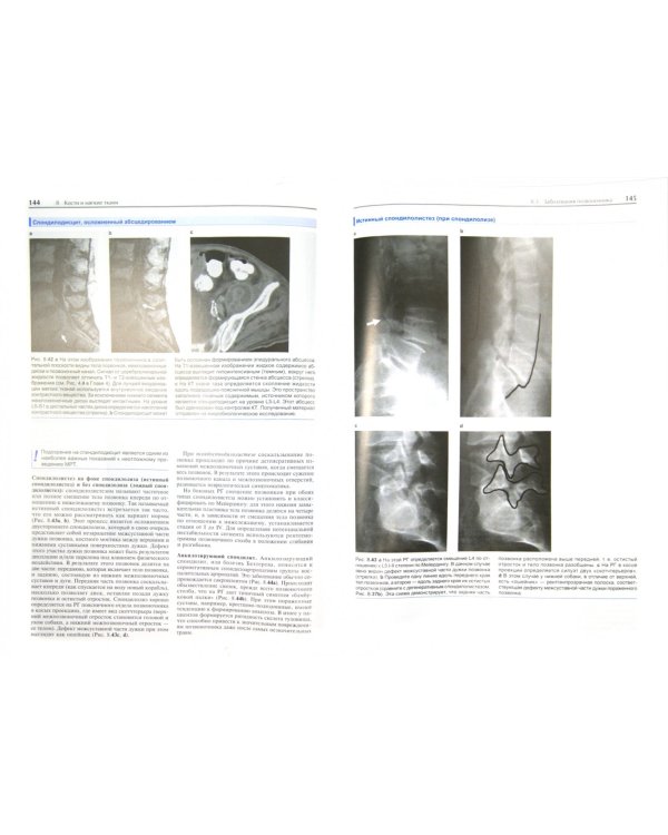 Основы лучевой диагностики. От изображения к диагнозу