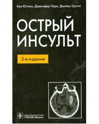 Острый инсульт