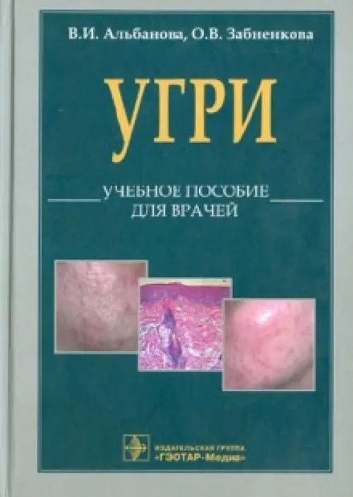 Обложка книги «L70. Угри. Учебное пособие для врачей» — Альбанова Вера Игоревна, Забненкова Ольга Владимировна, ISBN 9785970422830
