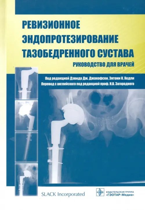 Ревизионное эндопротезирование тазобедренного сустава. Руководство для врачей Ревизионное эндопротезирование тазобедренного сустава. Руководство для врачей