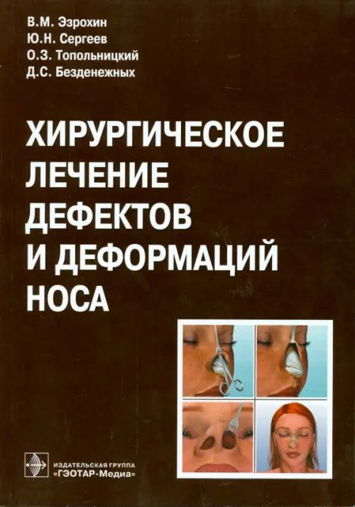 Хирургическое лечение дефектов и деформаций носа