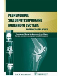 Ревизионное эндопротезирование коленного сустава. Руководство для врачей