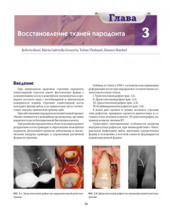 Дополнительное изображение книги «Регенеративные технологии в стоматологии. Научно-практическое руководство»