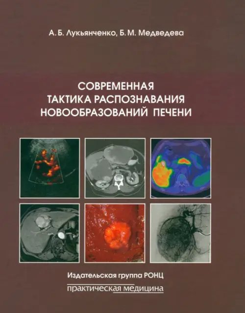 Современная тактика распознавания новообразований печени