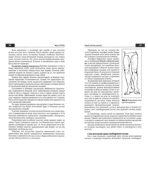 Правильное лечение ваших суставов от доктора Евдокименко