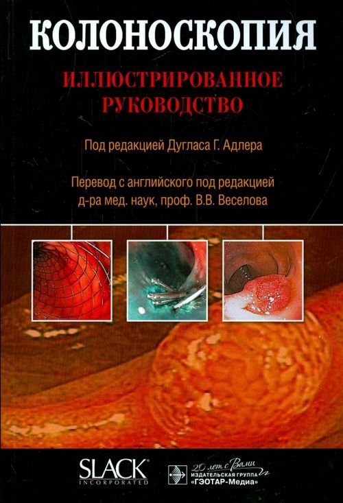 Колоноскопия. Иллюстрированное руководство