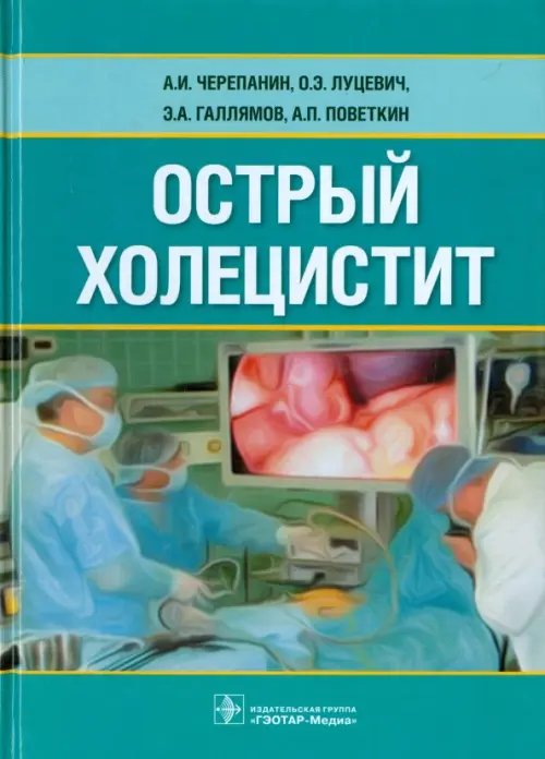 Острый холецистит Острый холецистит