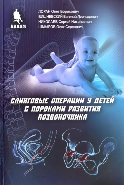 Слинговые операции у детей с пороками развития позвоночника Слинговые операции у детей с пороками развития позвоночника