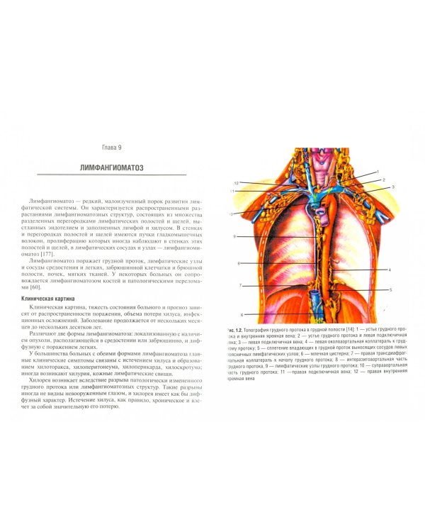 Хирургия грудного протока