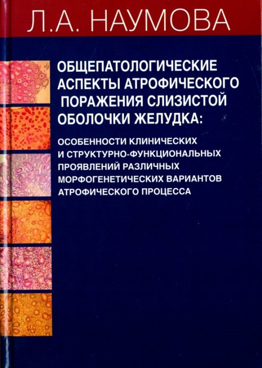 Общепатологические аспекты атрофического поражения слизистой оболочки желудка Общепатологические аспекты атрофического поражения слизистой оболочки желудка