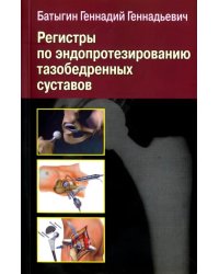 Регистры по эндопротезированию тазобедренных суставов