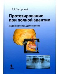 Протезирование при полной адентии