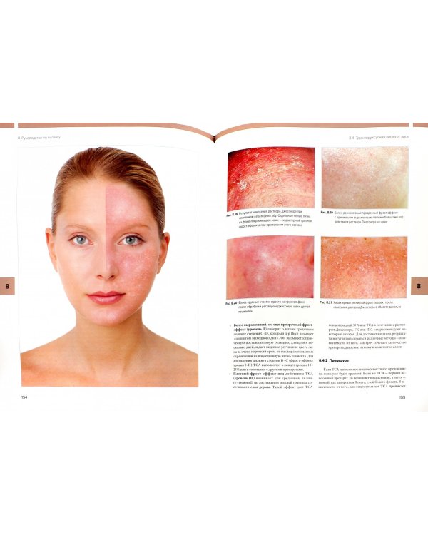 Иллюстрированное руководство по химическим пилингам. Основы. Показания. Применение