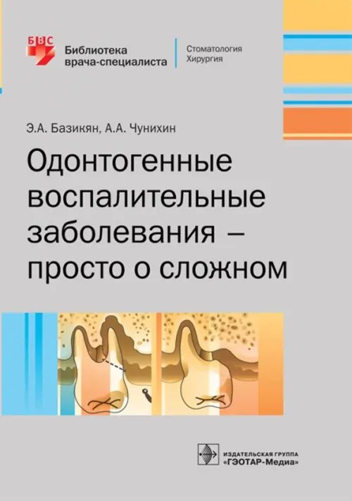 Одонтогенные воспалительные заболевания - просто о сложном Одонтогенные воспалительные заболевания - просто о сложном