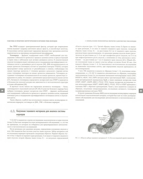Генетика в практике хирургического лечения рака желудка
