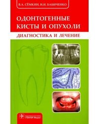 Одонтогенные кисты и опухоли. Диагностика и лечение