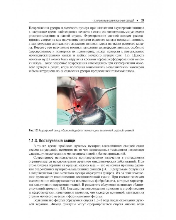 Ошибки и осложнения в урогинекологии