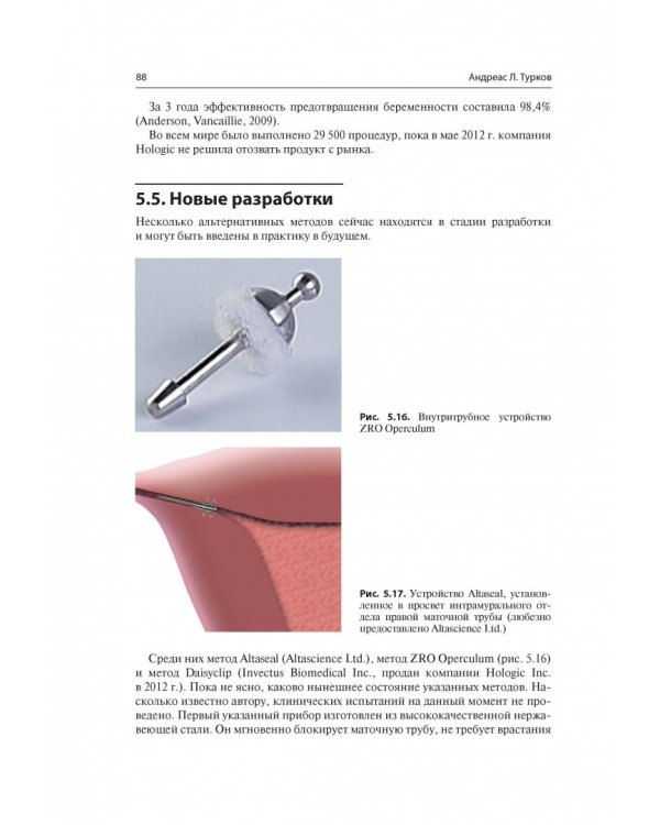 Мини-инвазивная гинекологическая хирургия