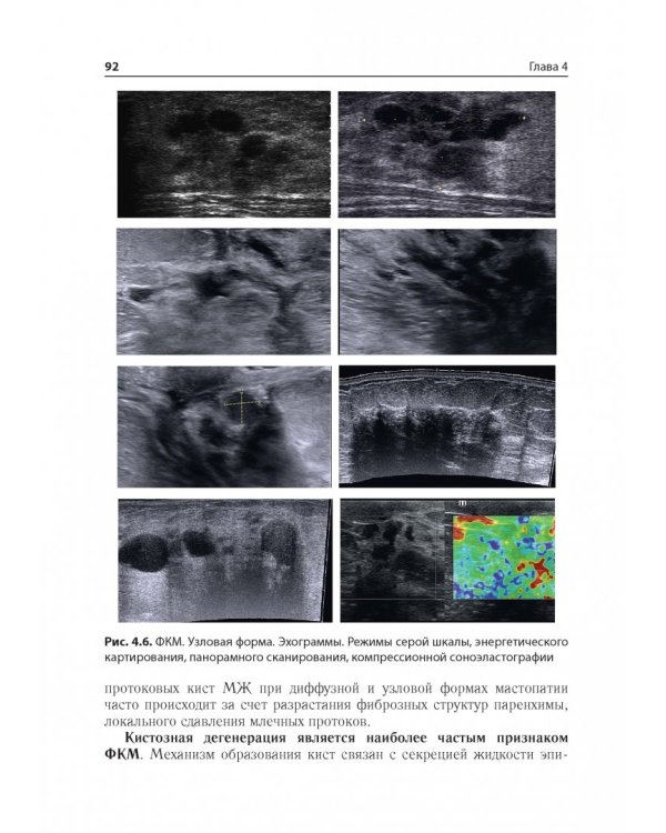 Ультразв.мультипарам.диагност.патолог.молочн.желез