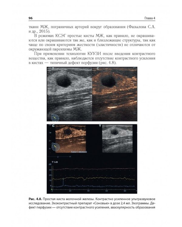 Ультразв.мультипарам.диагност.патолог.молочн.желез