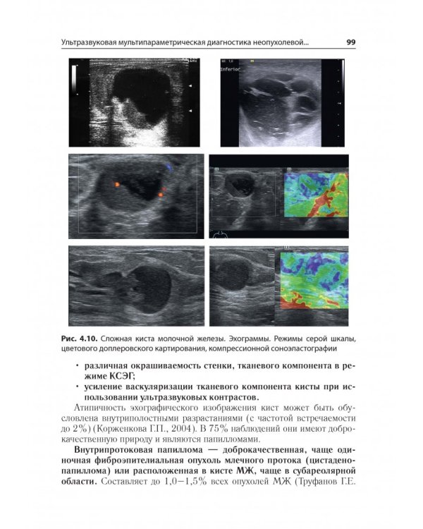 Ультразв.мультипарам.диагност.патолог.молочн.желез
