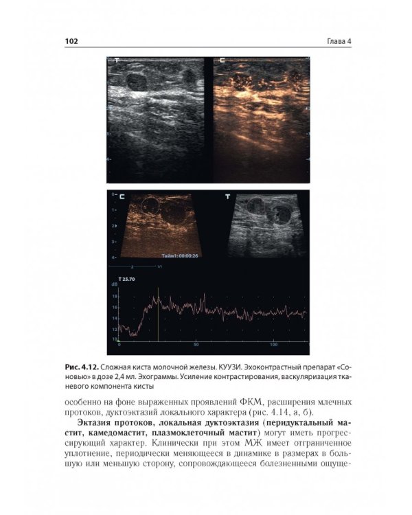 Ультразв.мультипарам.диагност.патолог.молочн.желез