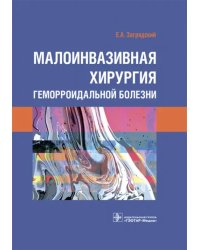 Малоинвазивная хирургия геморроидальной болезни