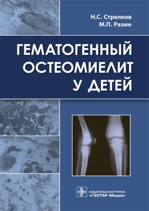 Гематогенный остеомиелит у детей